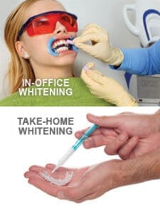 A dental patient enjoys a Teeth Whitening treatment in-office, while another image displays hands applying whitening gel to a tray for convenient take-home Teeth Whitening. Text: IN-OFFICE WHITENING and TAKE-HOME WHITENING.